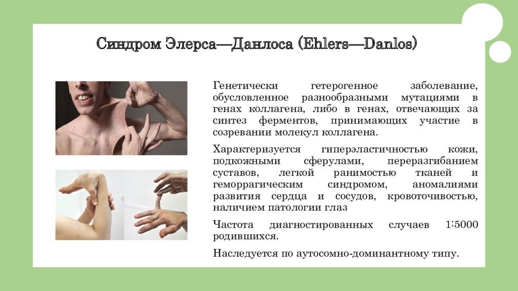 Preview «Джетс» испытывают трудности без Николая Элерса