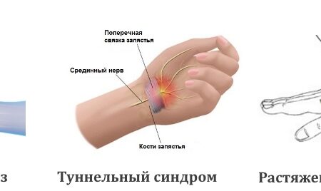 Зак Хайман из «Ойлерз»: вывих и разрыв связок запястья, надеется быть готовым к тренировочному лагерю