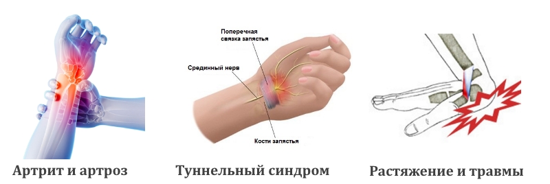 Preview Зак Хайман из «Ойлерз»: вывих и разрыв связок запястья, надеется быть готовым к тренировочному лагерю