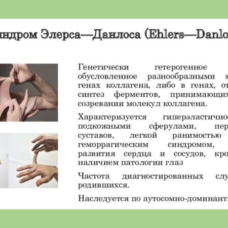 Семь потенциальных направлений для суперзвезды свободного агента Николая Элерса